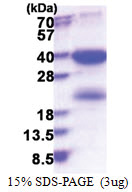 SKA1 (1-255, His-tag) Human Protein