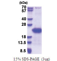 GTSF1 (1-167, His-tag) Human Protein