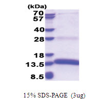 PACAP (1-97, His-tag) Human Protein PACAP (1-97, His-tag) Human Protein
