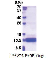 CSAG1 (20-78, His-tag) Human Protein