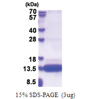 CSAG1 (20-78, His-tag) Human Protein
