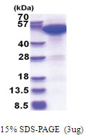 ERO1L (24-468, His-tag) Human Protein
