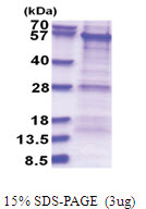 PKNOX1 (1-436, His-tag) Human Protein