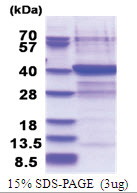 PLCXD3 (1-321, His-tag) Human Protein