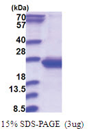 RWDD4 / RWDD4A (1-188, His-tag) Human Protein