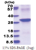 ABHD12B (1-255, His-tag) Human Protein
