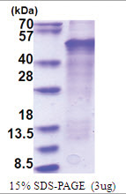 LMX1B (1-395, His-tag) Human Protein