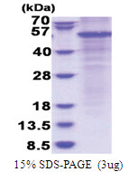 Properdin (28-469, His-tag) Human Protein