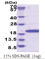 POP7 (1-140, His-tag) Human Protein