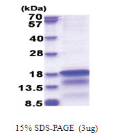 HCV-Core (1-120, His-tag) Human Protein