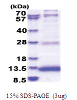 JTB (31-105, His-tag) Human Protein