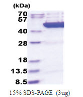 Citrate synthase (28-466, His-tag) Human Protein