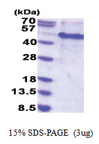 MAK16 / RBM13 (1-300, His-tag) Human Protein