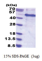 MAK16 / RBM13 (1-300, His-tag) Human Protein