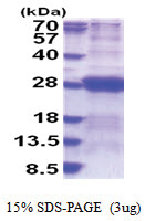 Dynactin subunit 6 (1-190, His-tag) Human Protein