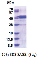 AGPHD1 (1-373, His-tag) Human Protein