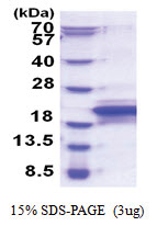 MOSPD1 (1-158, His-tag) Human Protein