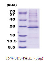MRPS23 (1-190, His-tag) Human Protein MRPS23 (1-190, His-tag) Human Protein