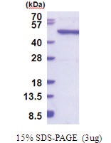 QTRTD1 (1-415, His-tag) Human Protein