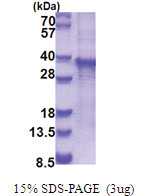 RASL12 / RIS (1-266, His-tag) Human Protein