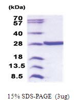 VCPKMT (1-229, His-tag) Human Protein VCPKMT (1-229, His-tag) Human Protein