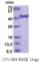 LRP2-binding protein / LRP2BP (1-347, His-tag) Human Protein LRP2-binding protein / LRP2BP (1-347, His-tag) Human Protein
