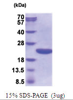 ppiA 25-190aa (His-tag) Human Protein
