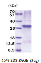 PTPN4 (655-913, His-tag) Human Protein