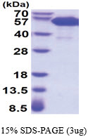 CD265 / RANK (28-212, His-tag) Human Protein