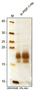 Placenta growth factor / PGF (His-tag) Human Protein