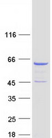 Coomassie blue staining of purified CORO2A protein (Cat# TP300403). The protein was produced from HEK293T cells transfected with CORO2A cDNA clone (Cat# RC200403) using MegaTran 2.0 (Cat# TT210002).