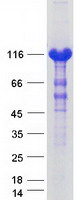 Coomassie blue staining of purified ACLY protein (Cat# TP300508). The protein was produced from HEK293T cells transfected with ACLY cDNA clone (Cat# RC200508) using MegaTran 2.0 (Cat# TT210002).