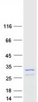 Coomassie blue staining of purified MIS12 protein (Cat# TP300789). The protein was produced from HEK293T cells transfected with MIS12 cDNA clone (Cat# RC200789) using MegaTran 2.0 (Cat# TT210002).