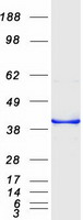 Coomassie blue staining of purified CDCA3 protein (Cat# TP300821). The protein was produced from HEK293T cells transfected with CDCA3 cDNA clone (Cat# RC200821) using MegaTran 2.0 (Cat# TT210002).