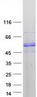 Coomassie blue staining of purified MICU1 protein (Cat# TP300921). The protein was produced from HEK293T cells transfected with MICU1 cDNA clone (Cat# RC200921) using MegaTran 2.0 (Cat# TT210002).