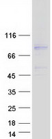 Coomassie blue staining of purified CCDC120 protein (Cat# TP300937). The protein was produced from HEK293T cells transfected with CCDC120 cDNA clone (Cat# RC200937) using MegaTran 2.0 (Cat# TT210002).