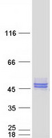 Coomassie blue staining of purified NUDT9 protein (Cat# TP300952). The protein was produced from HEK293T cells transfected with NUDT9 cDNA clone (Cat# RC200952) using MegaTran 2.0 (Cat# TT210002).