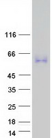 Coomassie blue staining of purified MXRA8 protein (Cat# TP300955). The protein was produced from HEK293T cells transfected with MXRA8 cDNA clone (Cat# RC200955) using MegaTran 2.0 (Cat# TT210002).