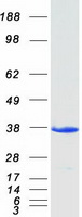 Coomassie blue staining of purified EFHD1 protein (Cat# TP300956). The protein was produced from HEK293T cells transfected with EFHD1 cDNA clone (Cat# RC200956) using MegaTran 2.0 (Cat# TT210002).