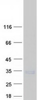 Coomassie blue staining of purified SEC22A protein (Cat# TP301512). The protein was produced from HEK293T cells transfected with SEC22A cDNA clone (Cat# RC201512) using MegaTran 2.0 (Cat# TT210002).