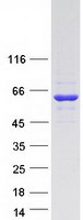 Coomassie blue staining of purified TRMT6 protein (Cat# TP301534). The protein was produced from HEK293T cells transfected with TRMT6 cDNA clone (Cat# RC201534) using MegaTran 2.0 (Cat# TT210002).