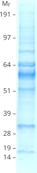 c-Myc (MYC) (NM_002467) Human Tagged ORF Clone – RC201611 | OriGene