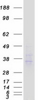 Coomassie blue staining of purified ACKR2 protein (Cat# TP302459). The protein was produced from HEK293T cells transfected with ACKR2 cDNA clone (Cat# RC202459) using MegaTran 2.0 (Cat# TT210002).