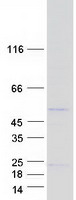 Coomassie blue staining of purified FAM167B protein (Cat# TP302563). The protein was produced from HEK293T cells transfected with FAM167B cDNA clone (Cat# RC202563) using MegaTran 2.0 (Cat# TT210002).