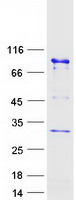 Coomassie blue staining of purified UTP3 protein (Cat# TP302643). The protein was produced from HEK293T cells transfected with UTP3 cDNA clone (Cat# RC202643) using MegaTran 2.0 (Cat# TT210002).