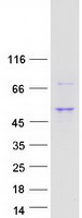 Coomassie blue staining of purified TMEM246 protein (Cat# TP302969). The protein was produced from HEK293T cells transfected with TMEM246 cDNA clone (Cat# RC202969) using MegaTran 2.0 (Cat# TT210002).