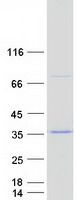 Coomassie blue staining of purified WASHC3 protein (Cat# TP303045). The protein was produced from HEK293T cells transfected with WASHC3 cDNA clone (Cat# RC203045) using MegaTran 2.0 (Cat# TT210002).