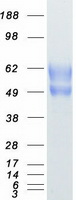 Coomassie blue staining of purified TPBG protein (Cat# TP303484). The protein was produced from HEK293T cells transfected with TPBG cDNA clone (Cat# RC203484) using MegaTran 2.0 (Cat# TT210002).
