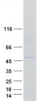 Coomassie blue staining of purified KLHDC3 protein (Cat# TP303552). The protein was produced from HEK293T cells transfected with KLHDC3 cDNA clone (Cat# RC203552) using MegaTran 2.0 (Cat# TT210002).