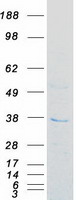 Coomassie blue staining of purified FN3KRP protein (Cat# TP303554). The protein was produced from HEK293T cells transfected with FN3KRP cDNA clone (Cat# RC203554) using MegaTran 2.0 (Cat# TT210002).